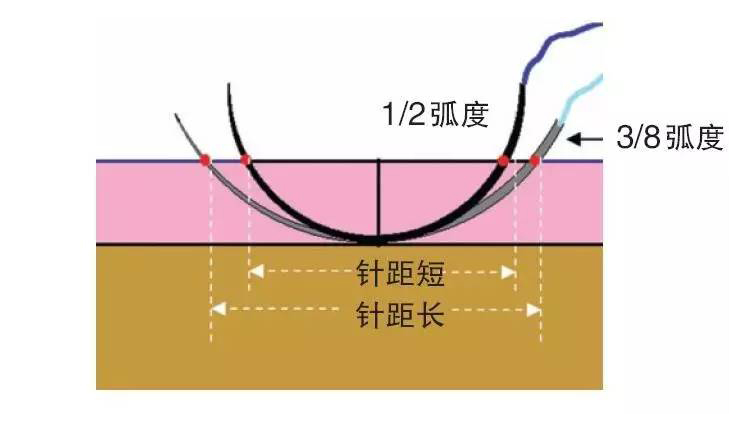 口腔種植選用針型弧度.jpg